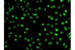 Immunofluorescence analysis of A-549 cells using PHF19 antibody (ABIN6128441, ABIN6145539, ABIN6145540 and ABIN6224090). (PHF19 Antikörper  (AA 1-207))