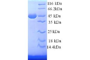 SDS-PAGE (SDS) image for Podocalyxin-Like (PODXL) (AA 32-458), (partial) protein (His tag) (ABIN5714282) (PODXL Protein (AA 32-458, partial) (His tag))