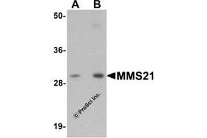 Western Blotting (WB) image for anti-E3 SUMO-Protein Ligase NSE2 (NSMCE2) (C-Term) antibody (ABIN1030522) (NSMCE2 Antikörper  (C-Term))