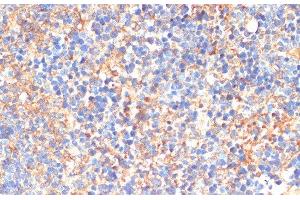 Immunohistochemistry of paraffin-embedded Mouse spleen using SIGLEC3/CD33 Polyclonal Antibody at dilution of 1:200 (40x lens). (CD33 Antikörper)