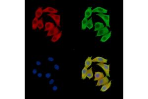ABIN7095504 and ABIN7099561 staining Hela cells by IF/ICC.