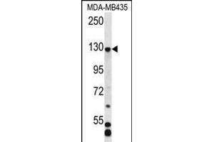 C7orf63 Antibody (N-term) (ABIN656362 and ABIN2845659) western blot analysis in MDA-M cell line lysates (35 μg/lane). (C7orf63 Antikörper  (N-Term))