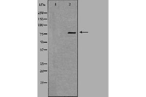 Western blot analysis of extracts from K562 cells, using ZNF420 antibody.