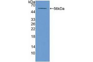 Detection of Recombinant ABCA13, Mouse using Polyclonal Antibody to ATP Binding Cassette Transporter A13 (ABCA13) (ABCA13 Antikörper  (AA 4692-4931))