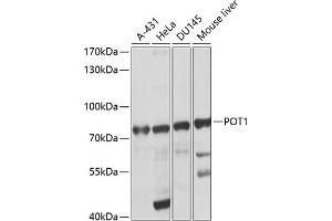 Western blot analysis of extracts of various cell lines, using POT1 antibody (ABIN3022020, ABIN3022021, ABIN5663924 and ABIN6218570) at 1:1000 dilution. (POT1 Antikörper  (AA 497-634))