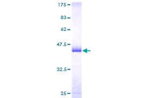 PTP4A1 Protein (AA 1-173) (GST tag)