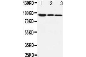 Anti-beta Catenin antibody, Western blotting Lane 1: MM453 Cell Lysate Lane 2: MCF-7 Cell Lysate Lane 3: HELA Cell Lysate (CTNNB1 Antikörper  (C-Term))