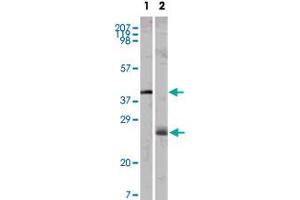 Western blot analysis using APOM monoclonal antibody, clone 10C3G5  against GST-APOM recombinant protein (1) and human serum (2).