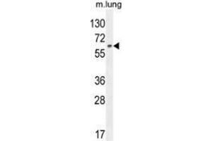 Western blot analysis in mouse lung tissue lysates (35ug/lane) using NFE2L1  Antibody (C-term). (NFE2L1 Antikörper  (C-Term))