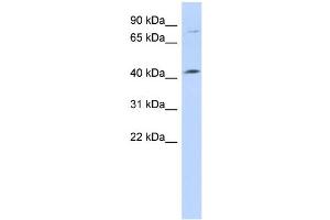 WB Suggested Anti-C1orf177 Antibody Titration: 0. (C1orf177 Antikörper  (Middle Region))
