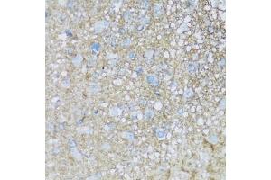 Immunohistochemistry of paraffin-embedded rat brain using B2 antibody (ABIN7265773) at dilution of 1:100 (40x lens). (ATP1B2 Antikörper  (AA 68-290))