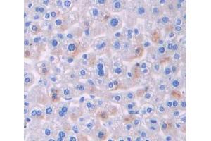 Used in DAB staining on fromalin fixed paraffin- embedded liver tissue (BCR Antikörper  (AA 1042-1268))
