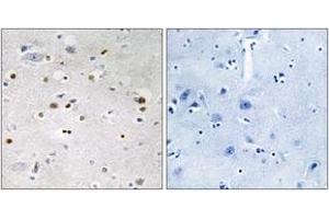 Immunohistochemistry analysis of paraffin-embedded human brain tissue, using ZNF7 Antibody. (ZNF7 Antikörper  (AA 41-90))
