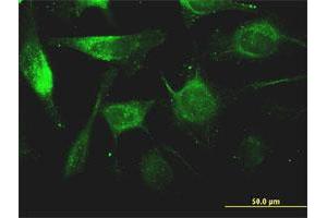 Immunofluorescence of monoclonal antibody to FTL on HeLa cell. (FTL Antikörper)