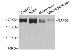 Western blot analysis of extracts of various cell lines, using SAFB2 antibody. (SAFB2 Antikörper  (AA 1-255))