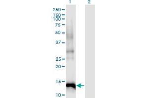 Western Blot analysis of CDKN2B expression in transfected 293T cell line by CDKN2B monoclonal antibody (M07), clone 8C4. (CDKN2B Antikörper  (AA 1-138))