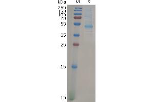 SDS-PAGE (SDS) image for GTPase Kras (KRAS) (AA 2-185) protein (mFc Tag) (ABIN7092689)