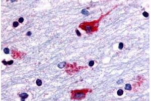 Immunohistochemical staining of human brain, neurons and glia with CHRM2 polyclonal antibody . (Muscarinic Acetylcholine Receptor M2 Antikörper  (Cytoplasmic Domain))