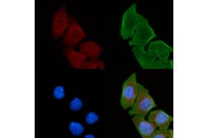 ABIN6263183 and ABIN6272343 staining Hela cells(30 min of UV treatment) by IF/ICC.