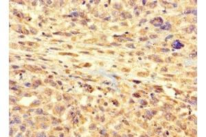 Immunohistochemistry (IHC) image for anti-Radial Spoke Head 9 Homolog (RSPH9) (AA 62-171) antibody (ABIN7167050)