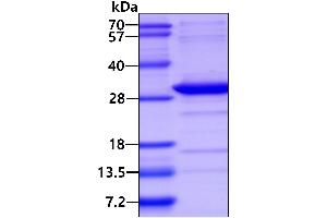 SDS-PAGE (SDS) image for V-Ral Simian Leukemia Viral Oncogene Homolog B (Ras Related, GTP Binding Protein) (Ralb) (AA 1-203) protein (His tag) (ABIN667855)