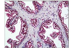 Human Prostate: Formalin-Fixed, Paraffin-Embedded (FFPE) (SMARCA4 Antikörper  (N-Term))