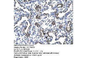 Human Lung (FOSB Antikörper  (C-Term))