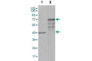 Western blot analysis using CHIT1 monoclonal antibody, clone 1D9G2  against truncated Trx-CHIT1 recombinant protein (1) and truncated CHIT1 (aa22-466)-hIgGFc transfected CHO-K1 cell lysate (2). (Chitotriosidase 1 Antikörper)