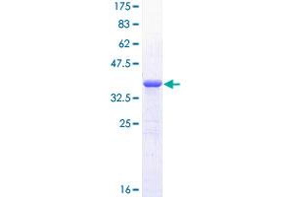 GLI1 Protein (AA 401-500) (GST tag)