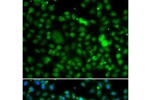 Immunofluorescence analysis of MCF-7 cells using NSUN6 Polyclonal Antibody (NSUN6 Antikörper)