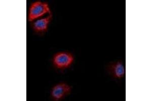 Immunofluorescent analysis of GPR170 staining in MCF7 cells. (OXER1 Antikörper)
