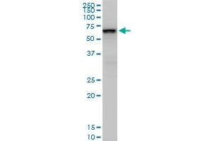 Western Blotting (WB) image for anti-SWI/SNF Related, Matrix Associated, Actin Dependent Regulator of Chromatin, Subfamily D, Member 2 (SMARCD2) (AA 398-474) antibody (ABIN520293)
