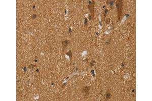Immunohistochemistry (IHC) image for anti-Nerve Growth Factor Receptor (TNFRSF16) Associated Protein 1 (NGFRAP1) antibody (ABIN2430497) (Nerve Growth Factor Receptor (TNFRSF16) Associated Protein 1 (NGFRAP1) Antikörper)