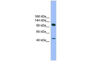 WB Suggested Anti-SEC23IP Antibody Titration: 0. (SEC23IP Antikörper  (N-Term))