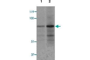 Western blot analysis of EZH1 in mouse lung tissue lysate with EZH1 polyclonal antibody  at 1 ug/mL (lane 1) and 2 ug/mL (lane 2). (EZH1 Antikörper  (N-Term))