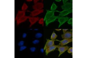 ABIN7095313 and ABIN7099370 staining Hela cells(45 min of heat-shock treatment) by IF/ICC. (C2CD2 Antikörper)