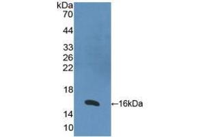 Western blot analysis of recombinant Human RARa. (Retinoic Acid Receptor alpha Antikörper  (AA 68-173))