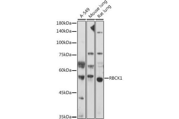 RBCK1 anticorps