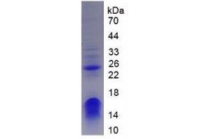 SDS-PAGE analysis of Human CHD3 Protein.