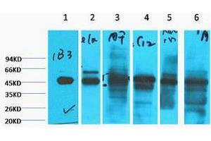 Western Blotting (WB) image for anti-Keratin 18 (KRT18) antibody (ABIN3178648)