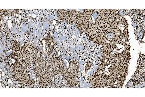 IHC analysis of Ku70 using anti-Ku70 antibody (ABIN7602791).