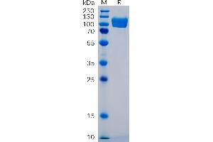 SDS-PAGE (SDS) image for Intercellular Adhesion Molecule 1 (ICAM1) (AA 48-480) protein (mFc Tag) (ABIN6961122)