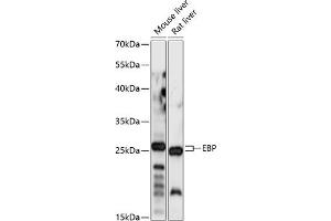 Western blot analysis of extracts of various cell lines, using EBP antibody (ABIN7266934) at 1:1000 dilution.