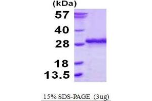 SDS-PAGE (SDS) image for SSU72 RNA Polymerase II CTD Phosphatase Homolog (SSU72) (AA 1-194) protein (His tag) (ABIN667667)