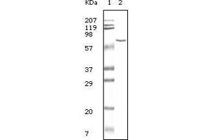 Western blot analysis using BSA mouse mAb antiobdy against BSA. (BSA Antikörper)