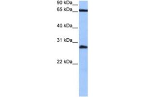 Western Blotting (WB) image for anti-Homeobox C6 (HOXC6) antibody (ABIN2463858) (Homeobox C6 Antikörper)