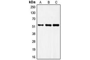 Western blot analysis of FRS3 expression in MCF7 (A), mouse brain (B), rat brain (C) whole cell lysates.