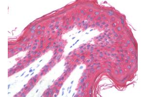 Anti-KRT8 / CK8 / Cytokeratin 8 antibody IHC staining of human skin.