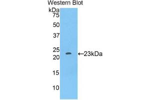 Western blot analysis of the recombinant protein. (SIGLEC12 Antikörper  (AA 317-512))