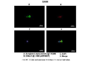 Immunohistochemistry (IHC) image for anti-Growth Arrest-Specific 8 (GAS8) (Middle Region) antibody (ABIN2783195) (GAS8 Antikörper  (Middle Region))